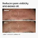 ord-niacinamide-zinc-blemish-serum-before-after-pores.webp