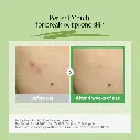 R_Torriden_Balanceful_Cica_Soothing_Cream_80ml.webp