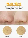Blackheads_4_2048x2048.webp